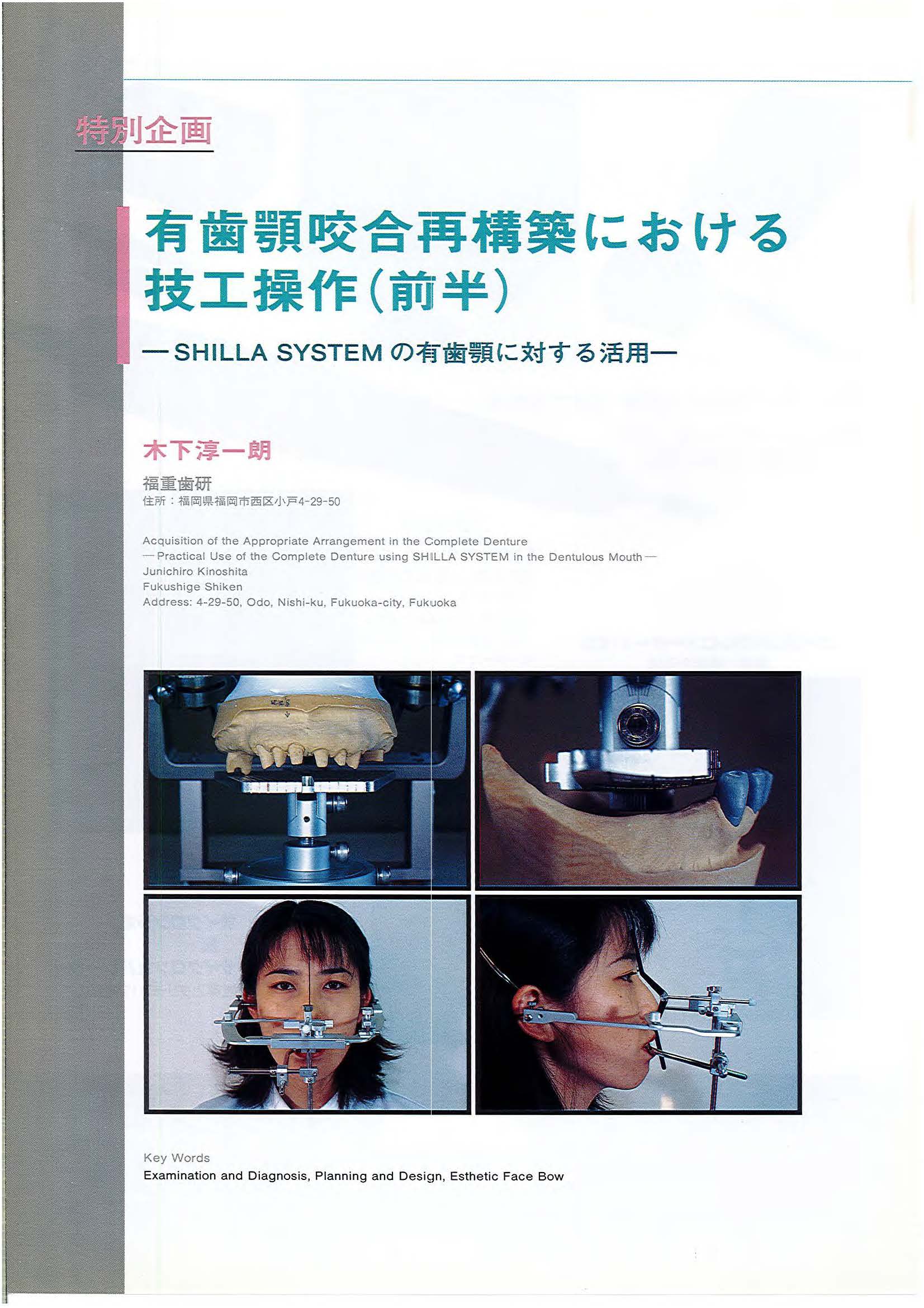 1998年論文・有歯顎咬合再構築における技工操作（前半）